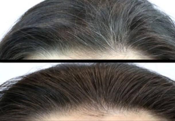 Saç Diplerindeki Beyazlar Seni de Yoruyorsa Buraya! İki Yeni Keşfim Sayesinde Beyazlar Artık Problem Değil!