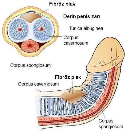 Bir Erkeğin Başına Gelebilecek En Kötü Şey: Penis Kırılması