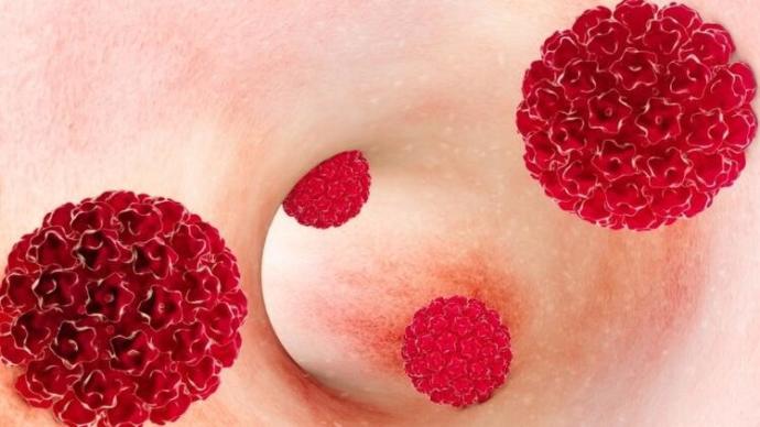 HPV Hakkında Bilmeniz Gereken Her Şey