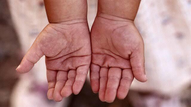 Daha Sağlıklı Bir Cilt için Duşta Bunları Yapmayın!