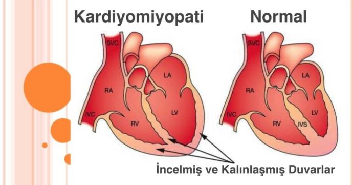 Bu Belirtileri Hafife Almayın: Kadınlarda Kalp Hastalıklarına Dikkat!