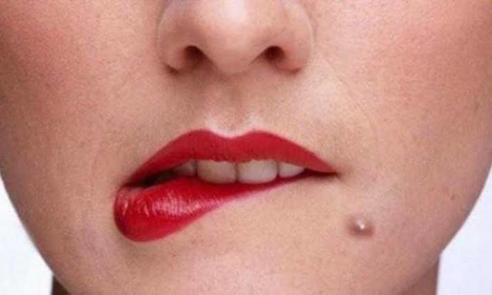 Kızlar Toplanın! Cildinizde Sivilcenin Çıktığı Yerlere Göre Anlamlarını Biliyor Muydunuz?