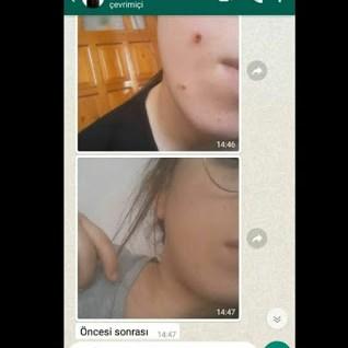 NoSoil: Mucizevi Bitkisel Ben Silme Kremini İnceliyoruz!