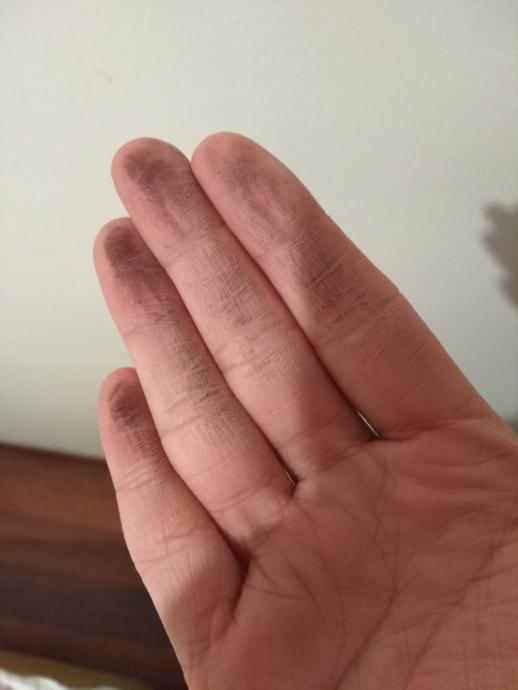Spreyi sıktıktan 3 saat sonrası😭 hafif elimi değdirmeme rağmen sonuç bu..