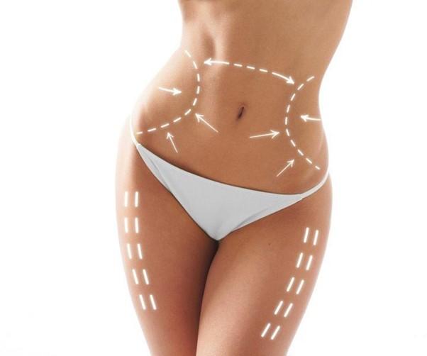 Bölgesel Fazlalıklar için En Etkili Yöntem: Liposuction