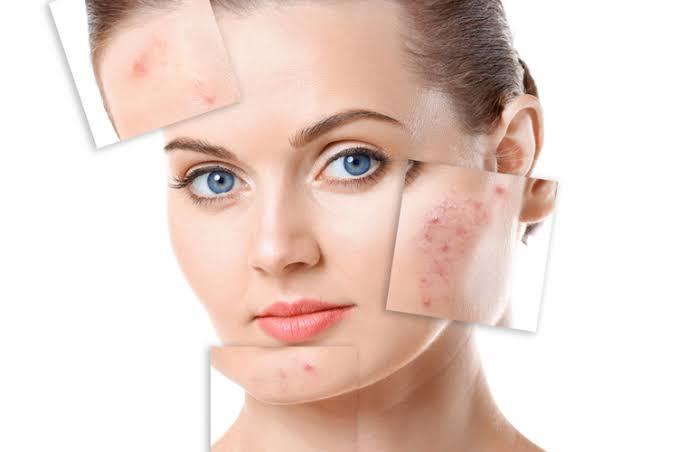 Maskenin Yıprattığı Cildimizi En Doğru Şekilde Koruyalım!