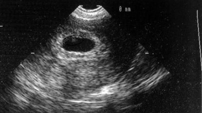 Gebelik Günlüğüm: Beni Korkutan Küçük Bir Melek!
