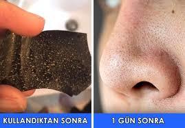 Siyah Nokta İle Baş Etme Yöntemleri!