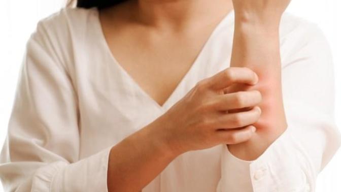 A'dan Z'ye Alerji Dosyası: Bilmek İsteyeceğiniz Her Şey Ve Daha Fazlası