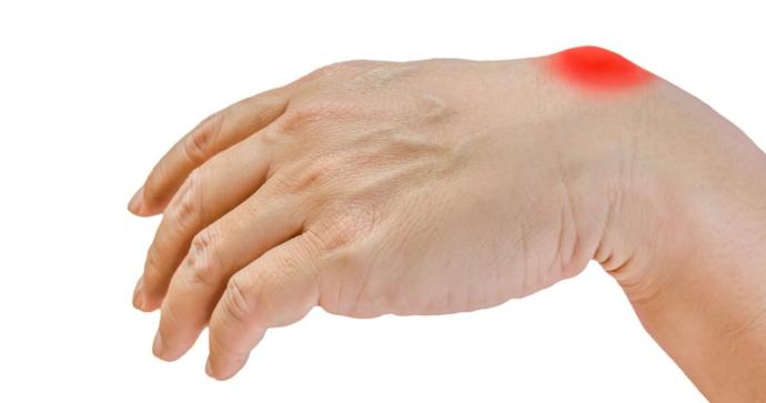Romatoid Artrit Nedir?