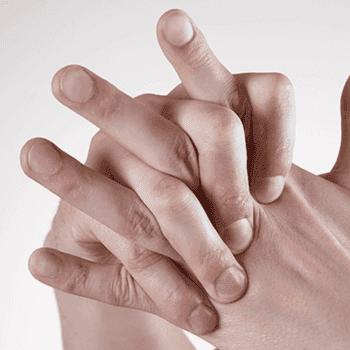 Romatoid Artrit Nedir?