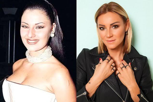 Güzellikleri ile Dillerde Dolaşan Ünlülerin Güzellikteki Değişimleri!