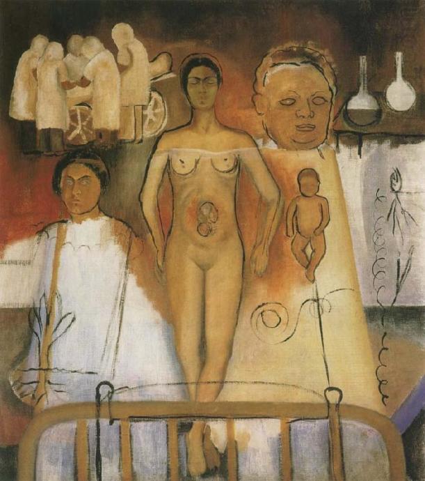 Frida and Caesarean Operation