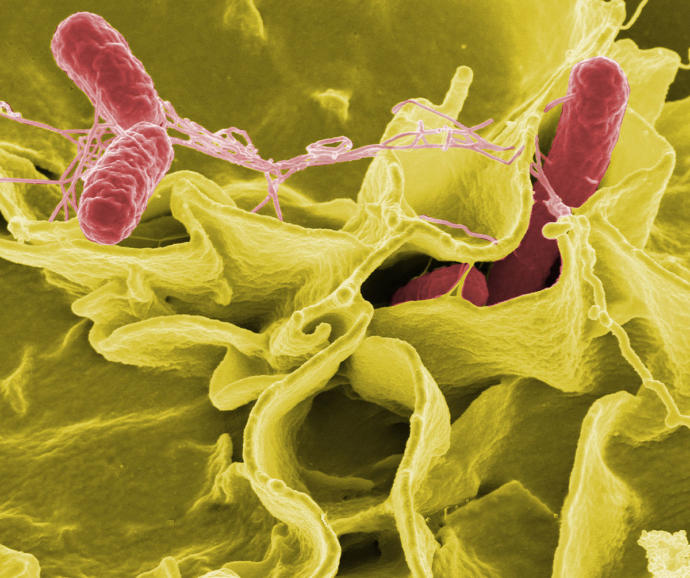 Salmonella Enfeksiyonunu Duydunuz Mu? Belirtileri Nelerdir? Korunmak için Neler Yapmalıyız?