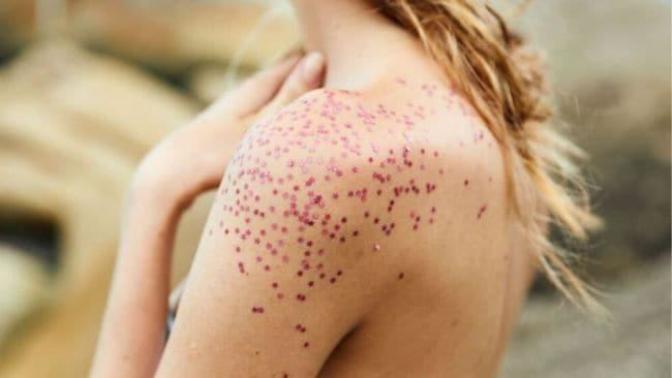 Keratosis Pilaris (Tavuk Derisi) Hastalığıyla Mücadelem!