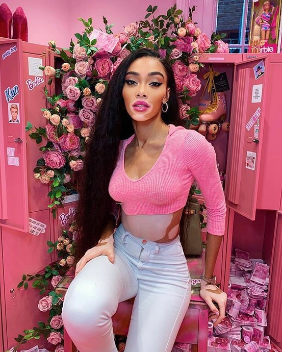 Klişe Güzellik Algılarını Sabri Misali Saha Dışına Yollayan Bir Melek: Winnie Harlow!