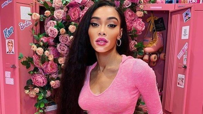 Klişe Güzellik Algılarını Sabri Misali Saha Dışına Yollayan Bir Melek: Winnie Harlow!