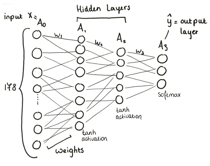 Neural Network