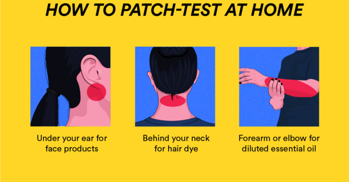 patch test yerleri