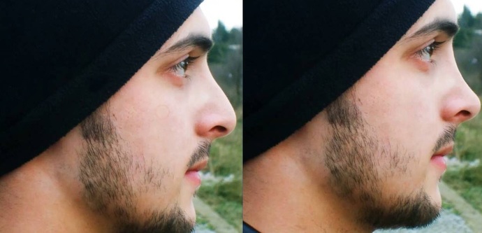 Photoshop İle Burun Estetiği Nasıl Yapılır?