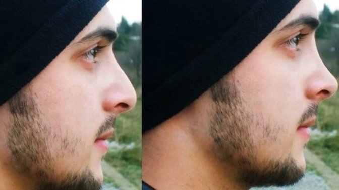 Photoshop İle Burun Estetiği Nasıl Yapılır?