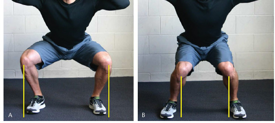 Squat Nedir? Doğru Squat Nasıl Yapılır?