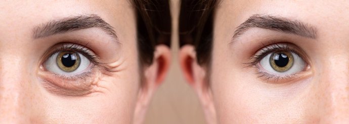 Sizi Göz Çevrenizdeki Kırışıklıklardan Kurtaracak Bir Japon Masajı: Shiatsu