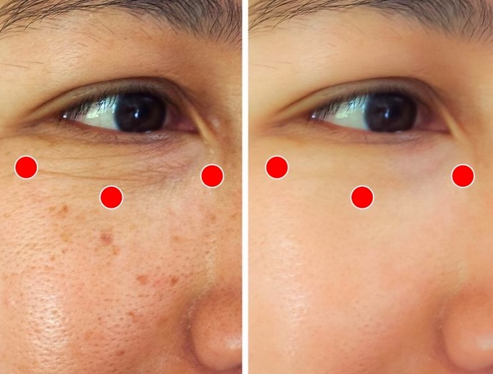 Sizi Göz Çevrenizdeki Kırışıklıklardan Kurtaracak Bir Japon Masajı: Shiatsu