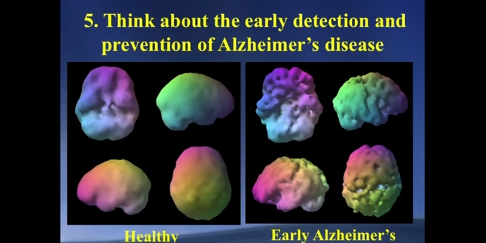 Sağlıklı bir beyin ve erken alzheimer
