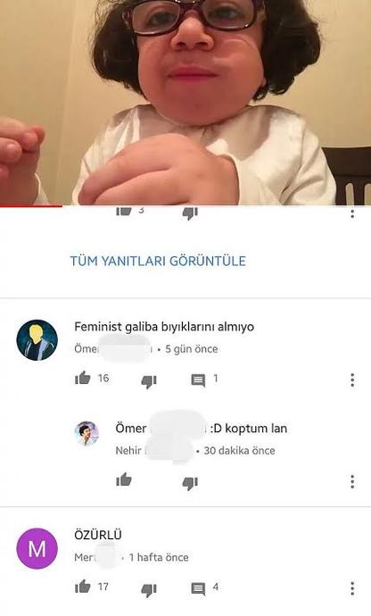 Resimdeki çocuk engelli bir çocuk! Yorumlara bakın, yazık...