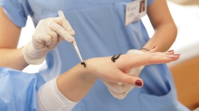 Sivilce ve Leke Problemleri Olanlar Toplansın: Sülük Tedavisi Sürecimi Anlatıyorum!