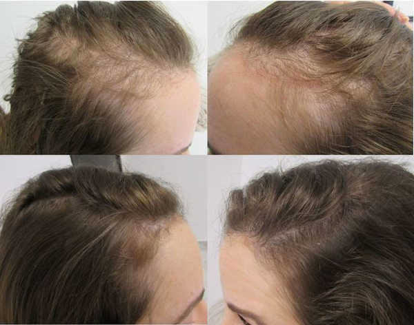 ✂️