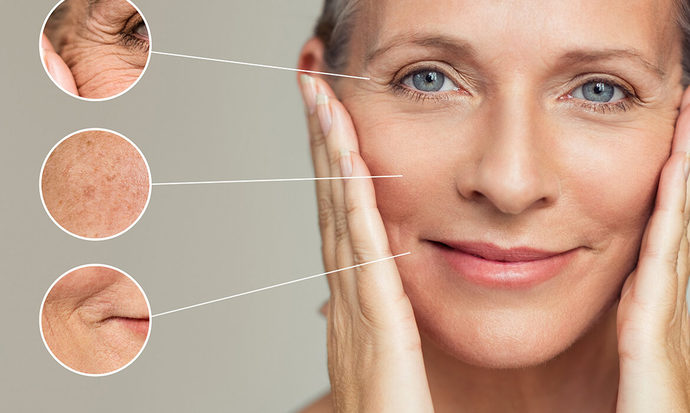 Peeling Nedir, Cilde Faydaları Nelerdir? Evde Peeling Tarifi Veriyorum!
