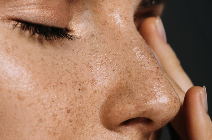 Peeling Nedir, Cilde Faydaları Nelerdir? Evde Peeling Tarifi Veriyorum!