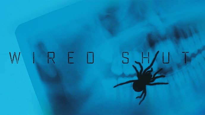 Çene Ameliyatı Geçirmiş Bir Adamın Beklenmedik Misafiri: Wired Shut