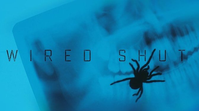 Çene Ameliyatı Geçirmiş Bir Adamın Beklenmedik Misafiri: Wired Shut