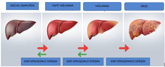 Karaciğer Yağlanması