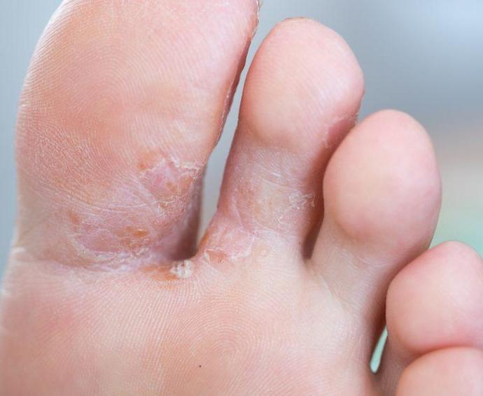 Eczaneden Alırken Çekinilen Ürünler