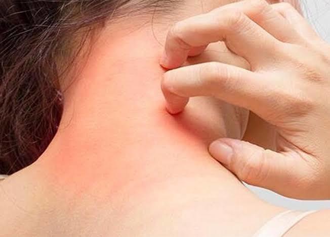 Eczaneden Alırken Çekinilen Ürünler