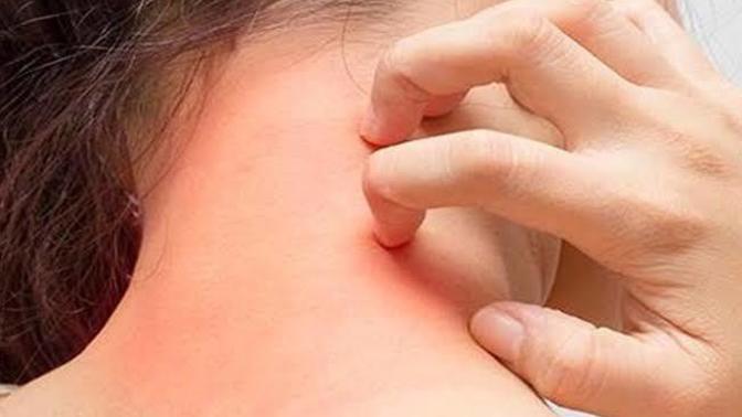 Eczaneden Alırken Çekinilen Ürünler