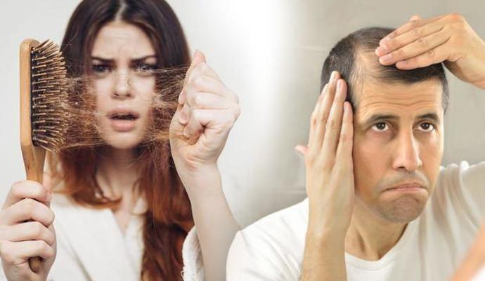 Saçlarımız Neden Kalıcı Olarak Dökülür? Bilimsel Yönden Açıklıyorum!
