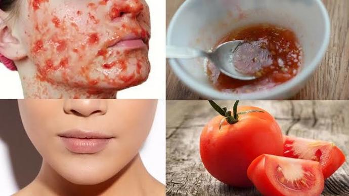 Yüzdeki Gözenekler İçin 5 Maske Önerim