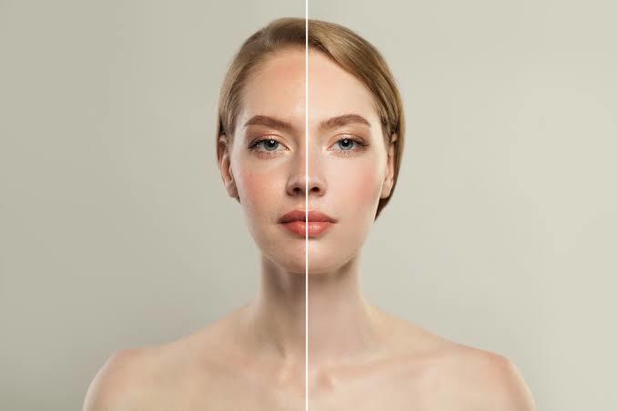 LOréal Paris Hyaluron Uzmanı Cilt Dolgunlaştıran Nemlendirici Krem Avantajları Nelerdir?