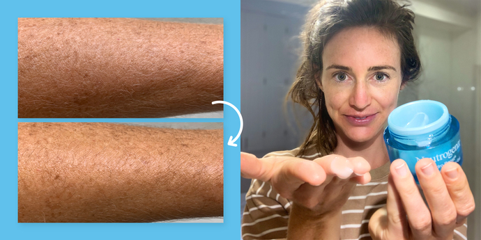 Kuru ya da Yağlı Cilt Problemi İle Savaşanlar: Neutrogena Hydro Boost Water Gel İle Tanışıyoruz!