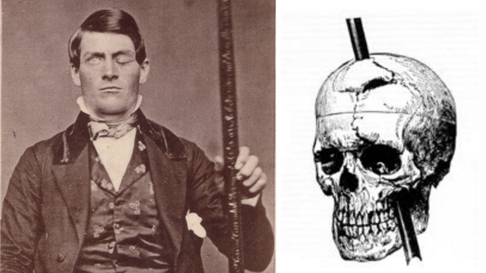 Kazanın kurbanı olan Phineas Gage