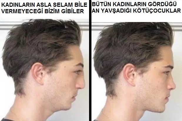 Black Pilli reddeden arsızdır, akılsızdır, ahlaksızdır.