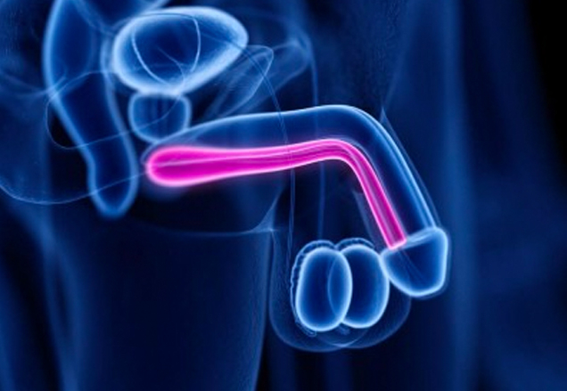 Penis eğriliği