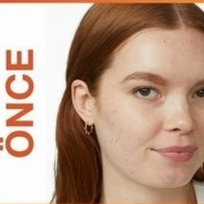 Önce/Sonra 🐥