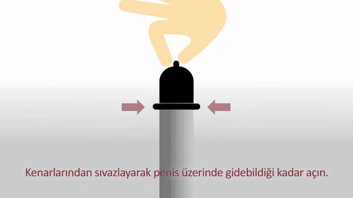 Prezervatif Kullanımının Önemi ve Dikkat Edilmesi Gereken Bazı Detaylar!
