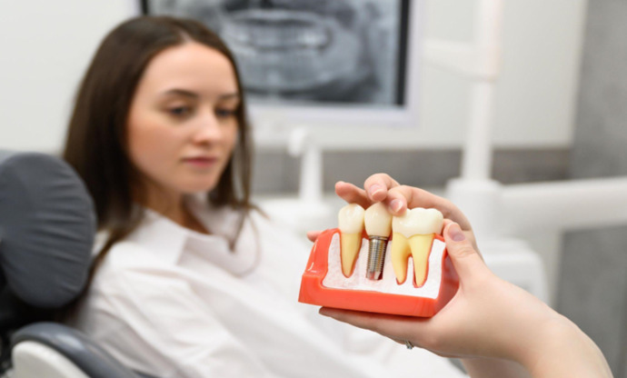 Kusursuz Gülümsemeye Ulaşmanın Sırrı: Hollywood Smile